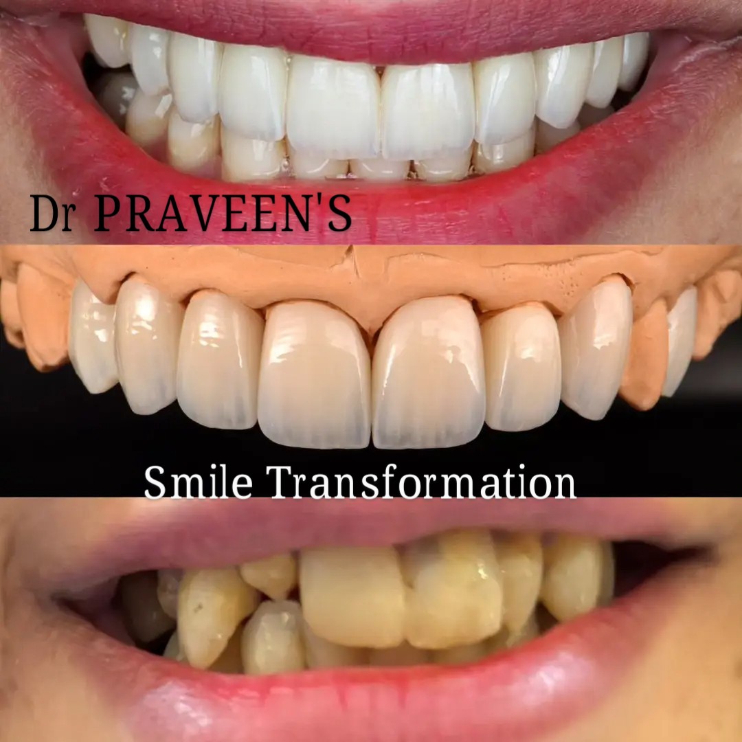 Clinical Case 4