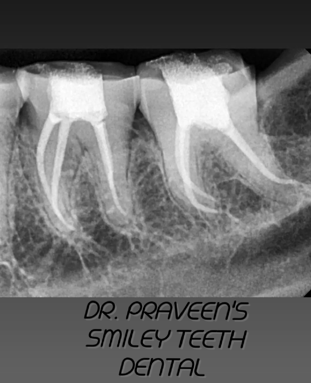 Clinical Case 1