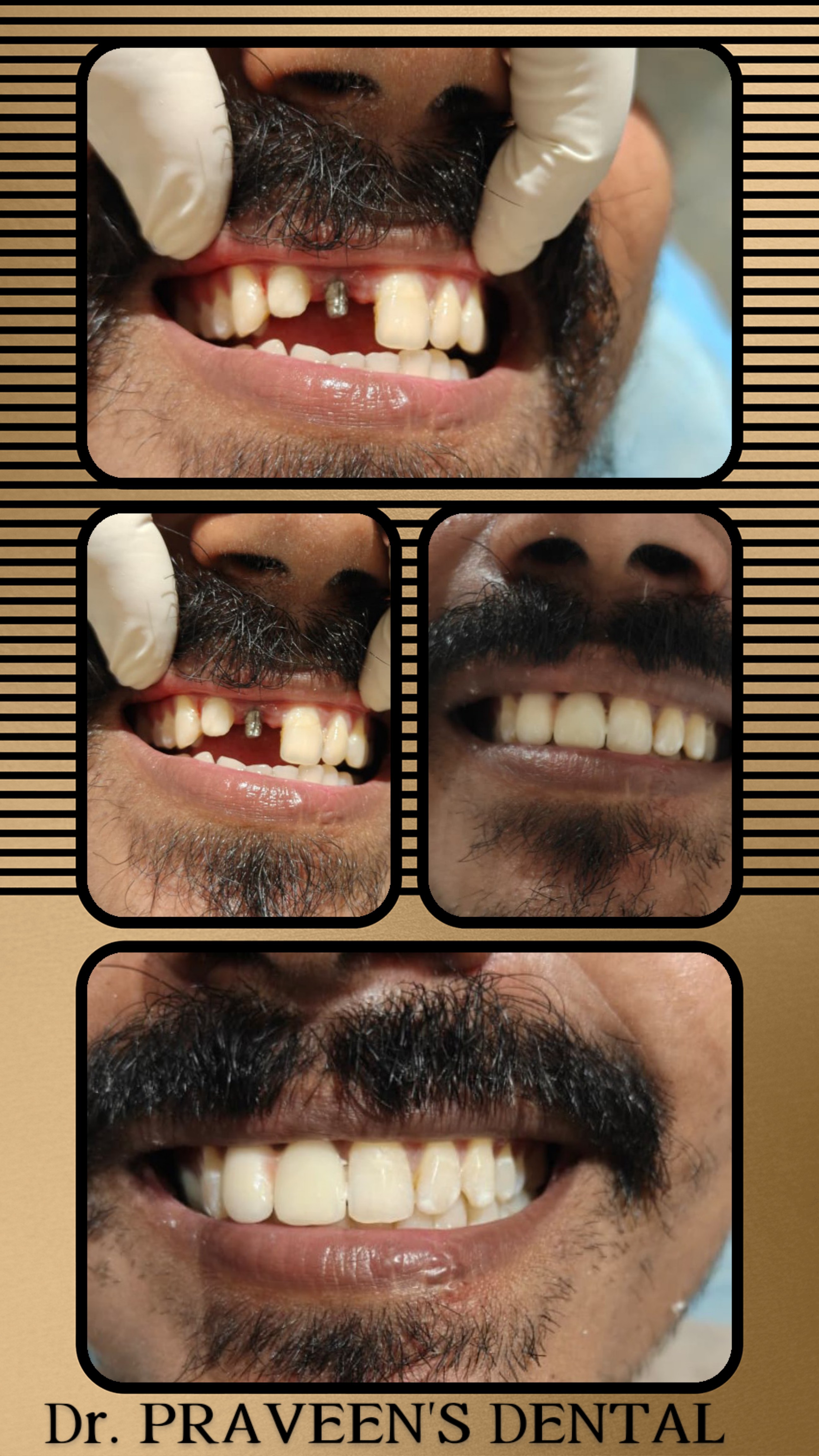 Clinical Case 2
