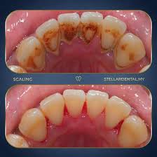 Before General Care