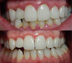After General Care